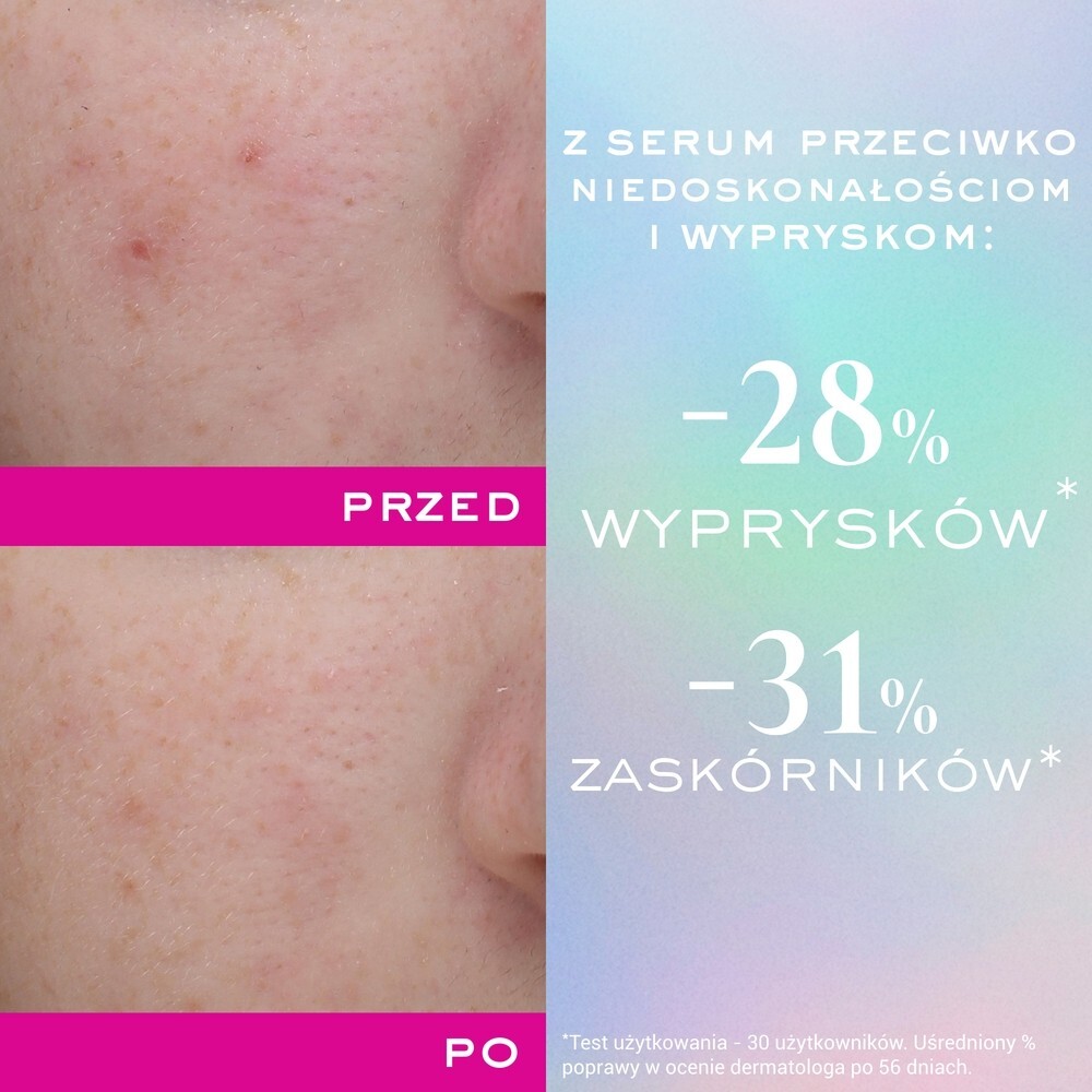 Nuxe Zinc Power Serum przeciw niedoskonałościom i wypryskom, 30 ml