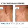 Uriage Bariederm-Cica Krem regenerujący, 40 ml